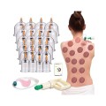 Cupping set