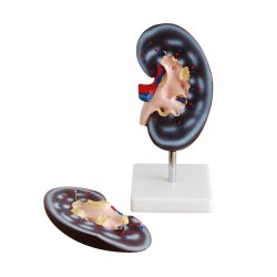 Kidney model (2 parts