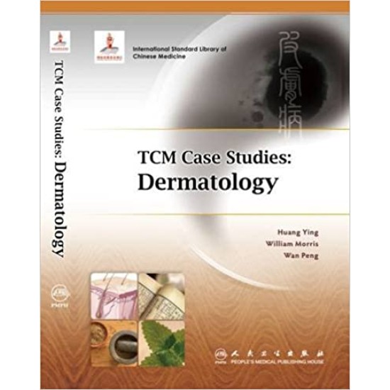 TCM Case Studies: Dermatology.  Ying Huang (auteur), William Morris (auteur), Peng Wan