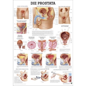 Die Prostata Poster 70x100cm Laminated
