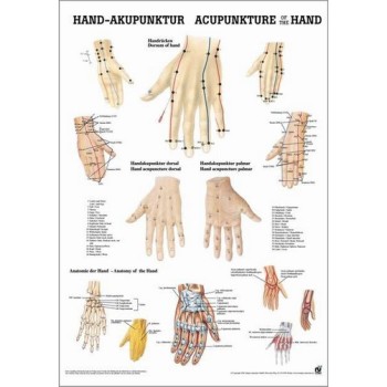 Acupuncture of the Hand Poster 50x70cm Laminated