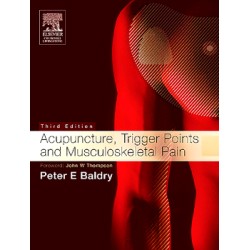 Acupuncture, Trigger Points and Musculoskeletal Pain